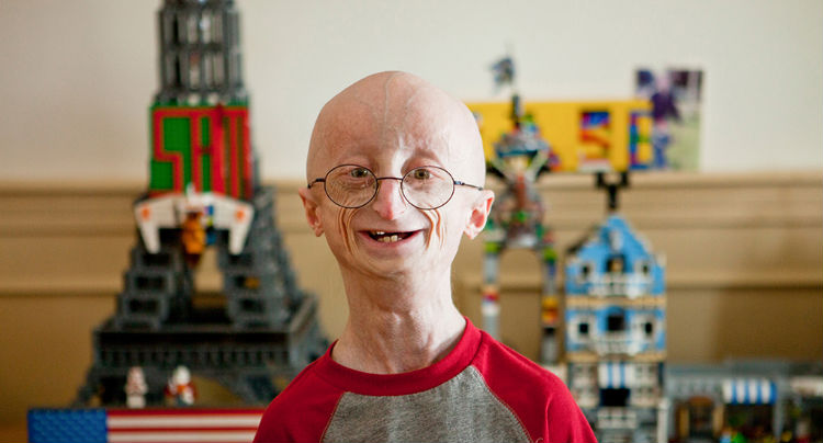 Sam Berns, Subject of ‘Life According to Sam’, Dies at 17